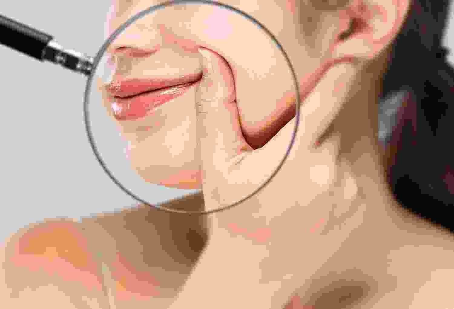 Plastic Surgery